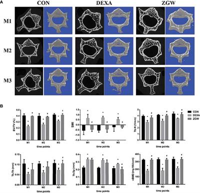 Zuo-Gui-Wan Aqueous Extract Ameliorates Glucocorticoid-Induced Spinal Osteoporosis of Rats by Regulating let-7f and Autophagy